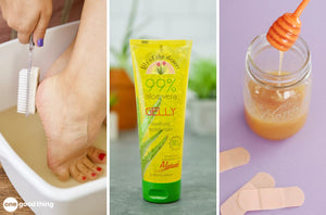 10 Easy Home Remedies For Summer Wounds And Ailments